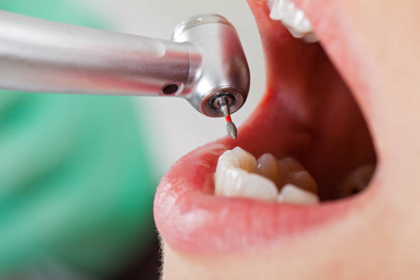 Best Pediatric Emergency Dentist in Eaton, IN